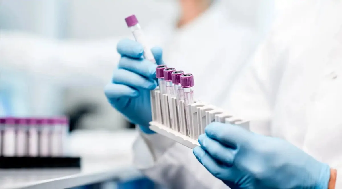 Как лабораторные анализы помогают понять причину боли в суставах и мышцах